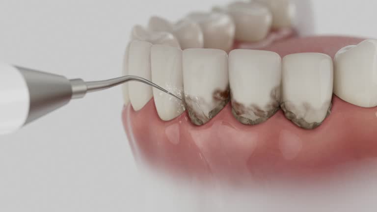 Trusted Tooth Extraction service in Perry, GA - Dentist Open Now